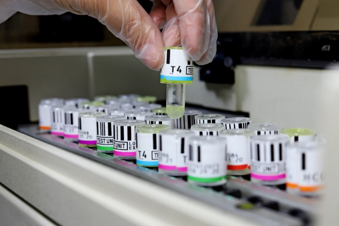 LQCE hoy, laboratorio acreditado MINSAL